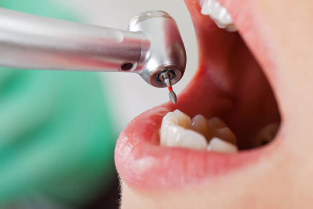 Best Emergency Root Canal Therapy in Denver City, TX